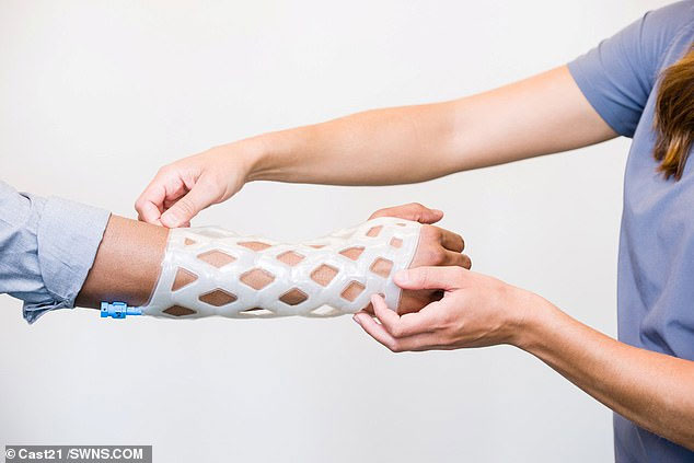 Khuôn bó bột kiểu mới